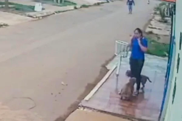 ataque feroz de cachorros deixa mulher com pernas dilaceradas