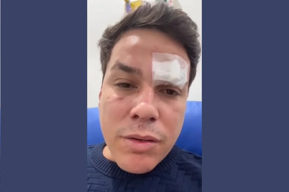 Após a agressão, o vereador Júlio Bento (PSD) esteve no hospital e levou três pontos no rosto Após a agressão, o vereador Júlio Bento (PSD) esteve no hospital e levou três pontos no rosto