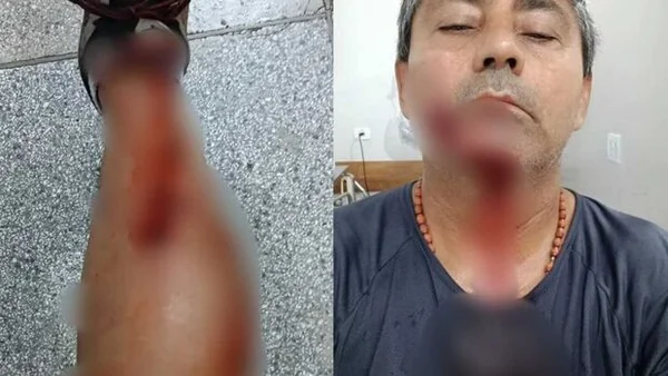 Pitbulls causam temor em Cassilândia após ataque que deixou três pessoas feridas (vídeo)