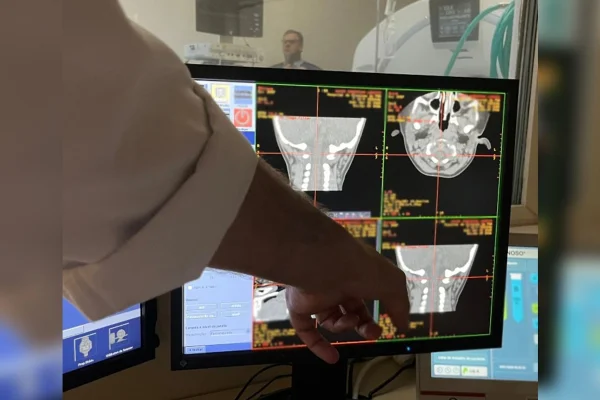 Foto colorida de médicos acompanhando exame de imagem de evolução do paciente - Fiocruz inicia teste em humanos de terapia gênica inédita contra AME - Metrópoles