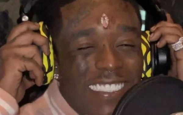 Rapper que implantou diamante na testa quer botar chip no cérebro: “Tô pronto” - destaque galeria