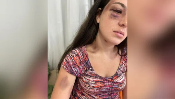 Agressão namorado influencer