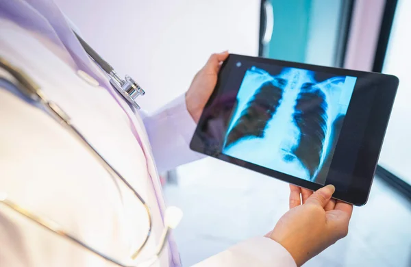Médico observa exame de imagem de um pulmão - tuberculose - Metrópoles câncer de pulmão