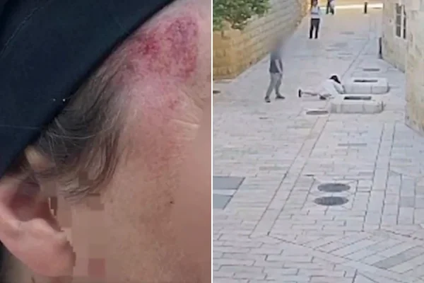 Imagem colorida mostra freira que foi agredida em Jerusalem - Metrópoles