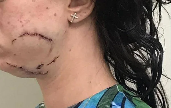Homem que agrediu mulher em orgia é servidor da Câmara dos Deputados