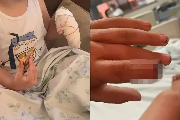 criança tem dedo amputado na escola, em goiânia, goiás