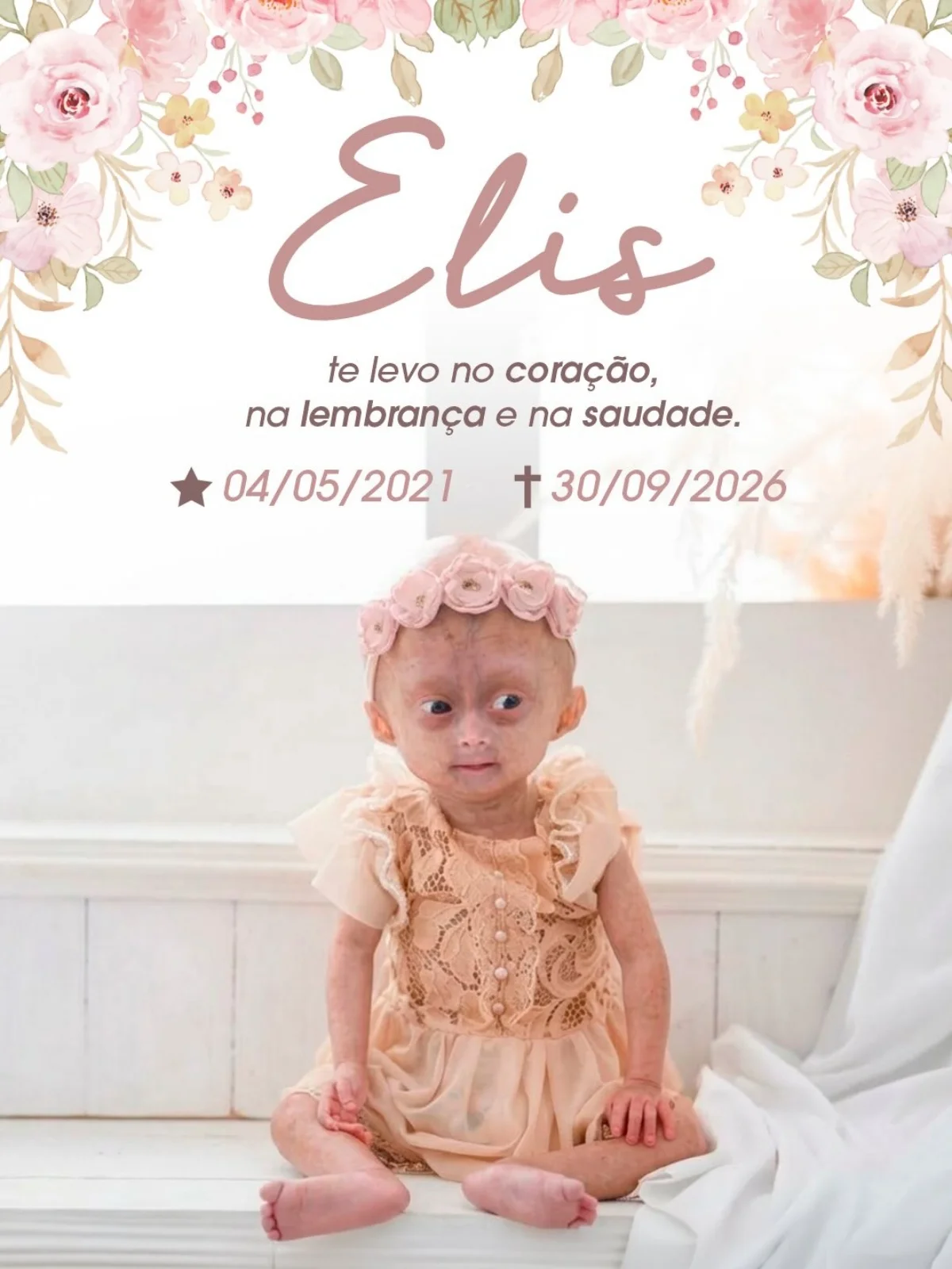 Morre Elis Carneiro Lima, menina de 5 anos diagnosticada com síndrome rara Morre Elis Carneiro Lima, menina de 5 anos diagnosticada com síndrome rara