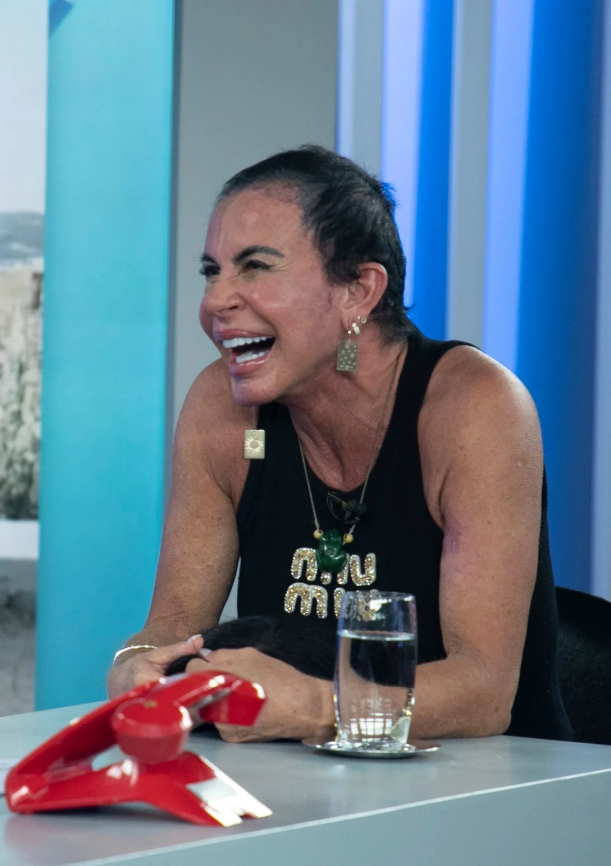 Gretchen tirou a peruca ao vivo e mostrou resultado de transplante capilar. Gretchen tirou a peruca ao vivo e mostrou resultado de transplante capilar.