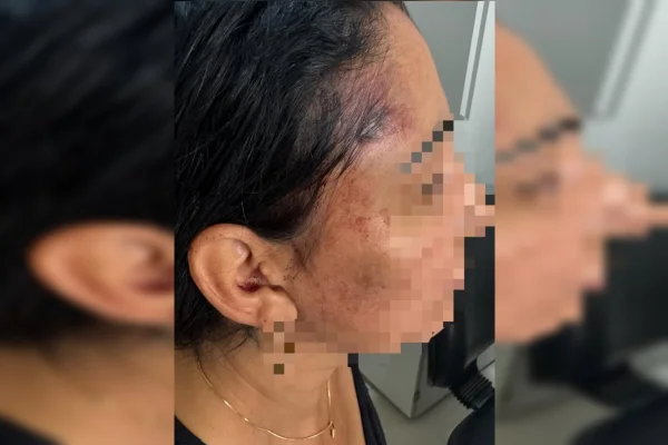 “Te mato”: homem é preso após ameaçar e agredir companheira com socos