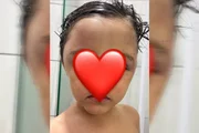 menino com olhos roxos menino com olhos roxos