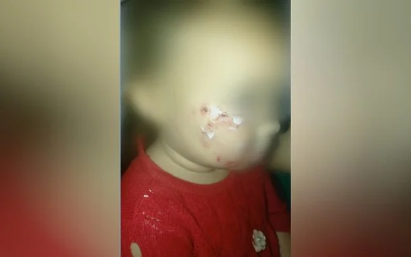 Babá diz que mãe proibiu socorro a criança atacada por cachorro