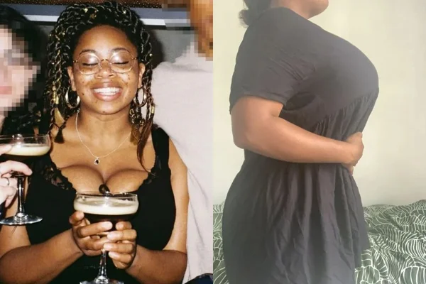 Mulher faz vaquinha para reduzir as mamas: “Não param de crescer”