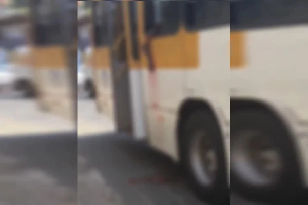 Imagem colorida, braço atingido por porte - Metrópoles