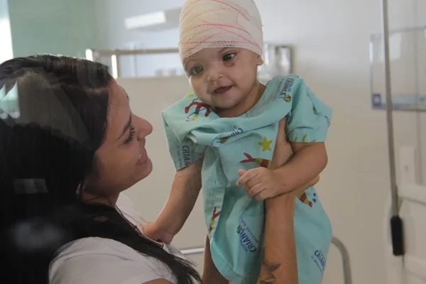 Mel, gêmea siamesa separada por cirurgia inédita, recebe alta da UTI