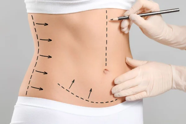 Cirurgia plastica