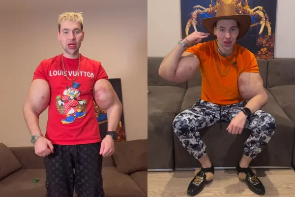 Foto colorida de um homem com braços grandes - Metrópoles