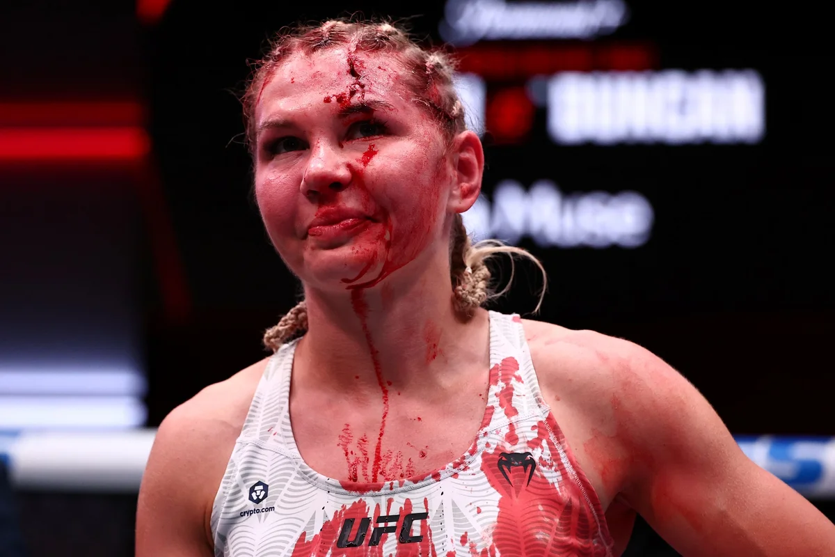 Daria Zhelezniakova ficou com corte profundo na testa após cotovelada da brasileira. Daria Zhelezniakova ficou com corte profundo na testa após cotovelada da brasileira.