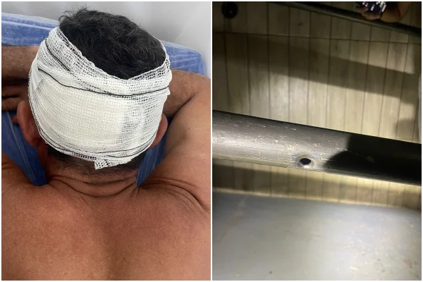Rejeitado por prostitutas, homem atira em cliente de bar. Veja imagens