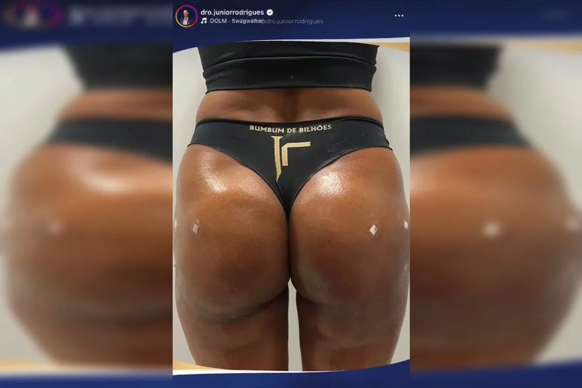 O falso médico postava nas redes sociais os procedimentos estéticos O falso médico postava nas redes sociais os procedimentos estéticos