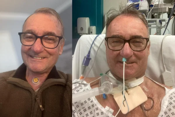Foto de Warwick Smith, homem que teve câncer laringe e perdeu as cordas vocais