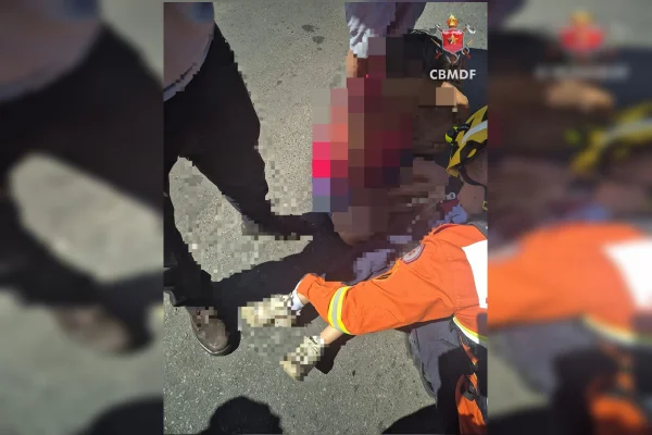 Criança fica ferida após ser atropelada por motociclista no DF
