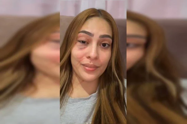 “Você provocou”, diz esposa de homem de cueca que atacou mulher no DF
