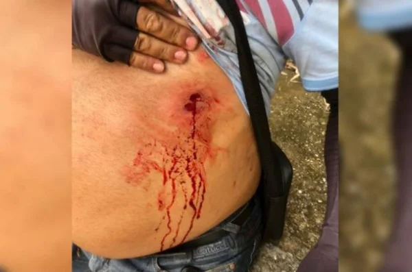 Homem baleado