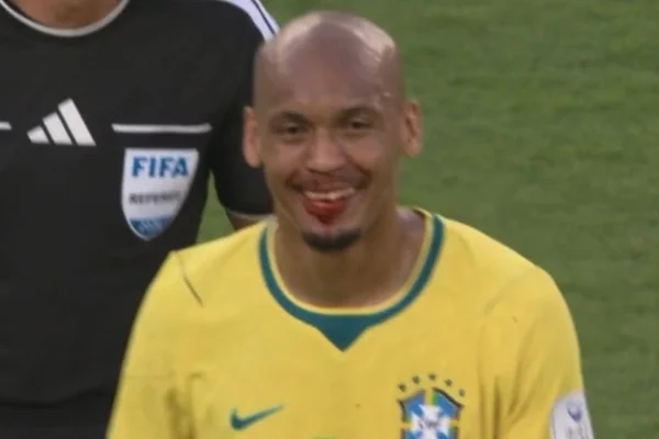 Copa: Fabinho sai com rosto sangrando e é atendido fora do gramado