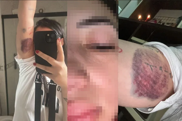 mulher agredida em corrida de app