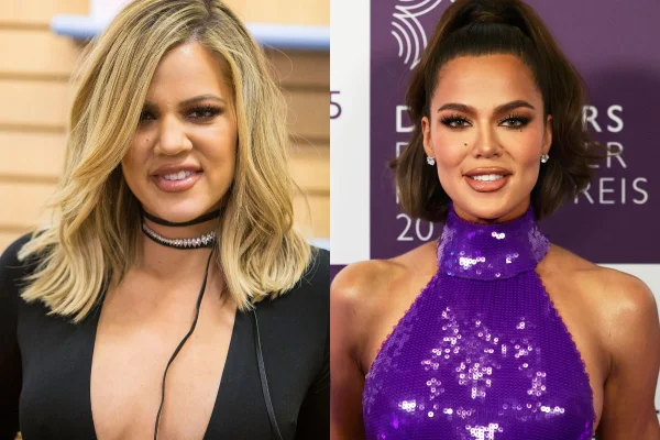 Khloé Kardashian