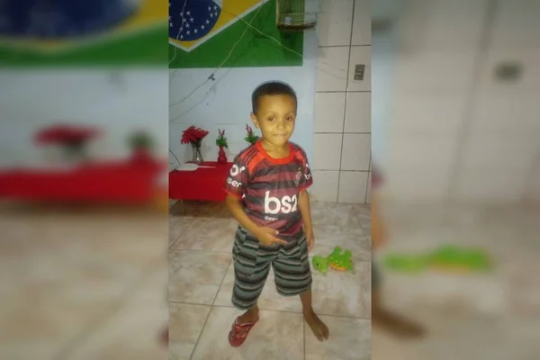 “Há esperança”, diz mãe de menino que teve 99% do corpo queimado