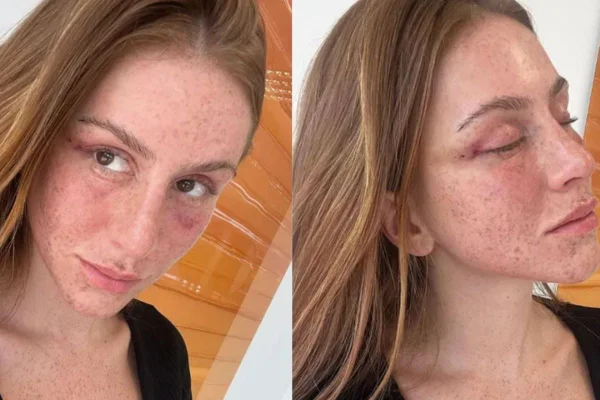 Fox eyes: conheça a técnica que deixa os olhos mais sensuais
