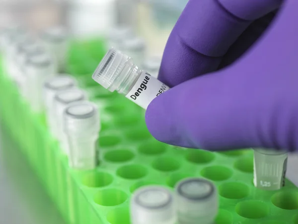 Imagem colorida mostra teste para diagnóstico de dengue - Metrópoles