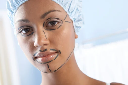 Rinoplastia supera silicone e se torna a plástica mais realizada