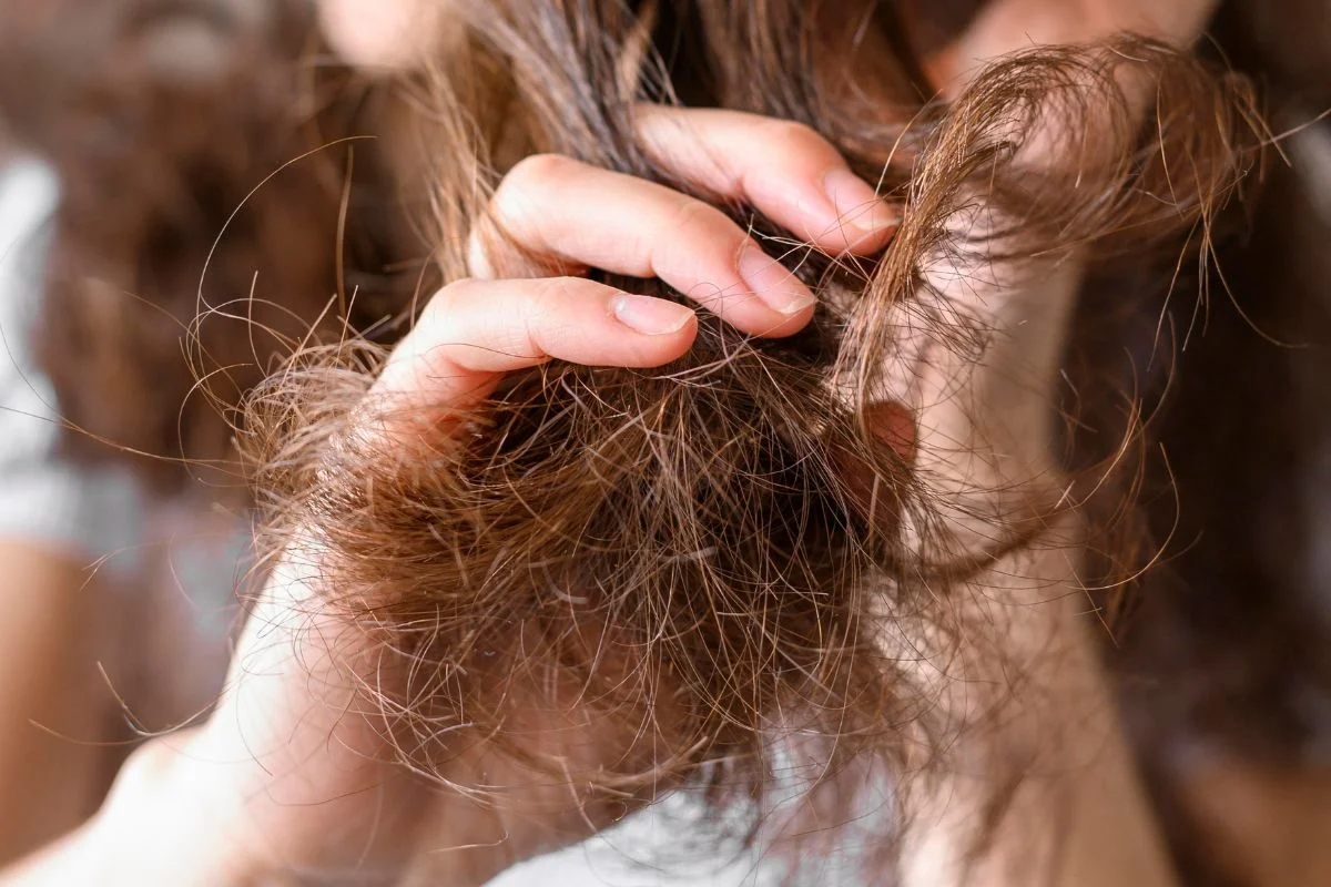Cabelo áspero e difícil de cuidar? Médicas explicam o que é scab hair