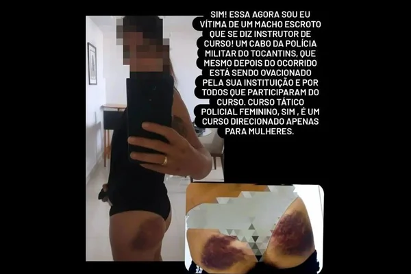 Imagem mostra policial que denunciou ter sido agredida por instrutor de curso no Ceará - Metrópoles