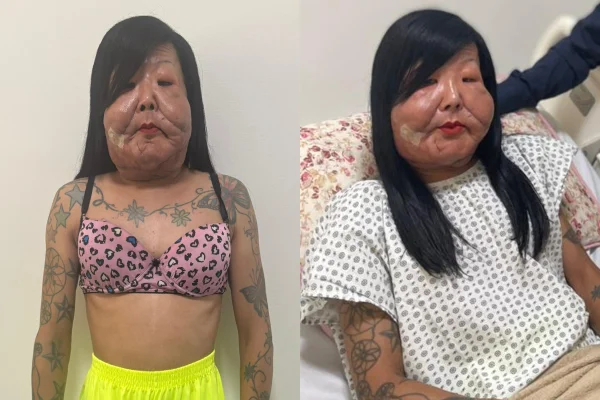 Juju do Pix passa por novo procedimento e médico explica detalhes