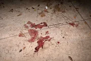 Rapaz foi levado ao hospital, mas não resistiu Rapaz foi levado ao hospital, mas não resistiu