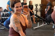 Cirurgia reparadora que Thais Carla fará precisa de cuidados; entenda Cirurgia reparadora que Thais Carla fará precisa de cuidados; entenda