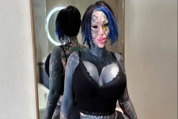 O antes e depois surreal de mulher viciada em cirurgias e tatuagem