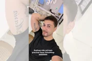 Carlinhos Maia exibindo o resultado do procedimento estético realizado na região da papada