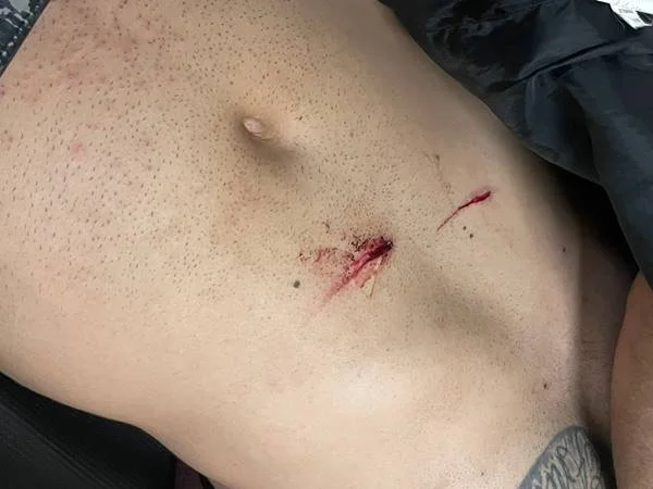Garçom é preso após esfaquear colega de trabalho durante briga em bar