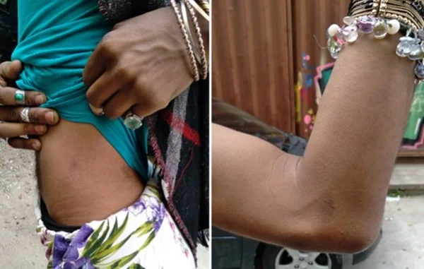 mulher trans agredida em sp