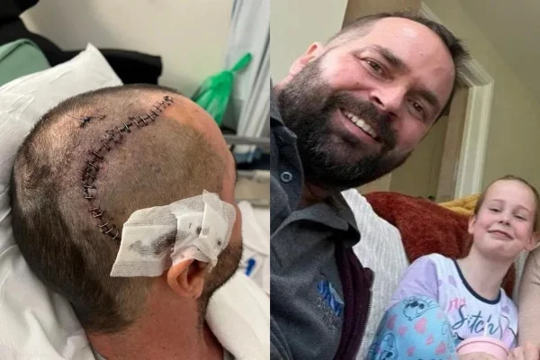 Homem descobre tumor cerebral grave após confundir sintomas com gripe