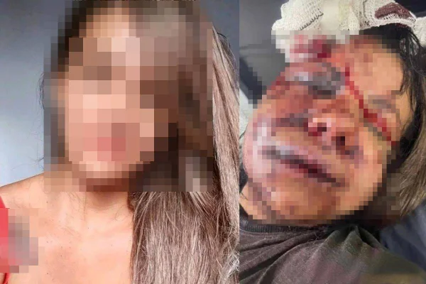 Mulher agredida por ex dentro de elevador em Natal - Metrópoles