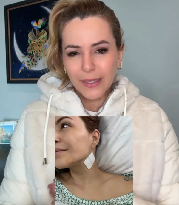 Musa do Carnaval tem nervo facial afetado após retirada de tumor na tiroide - destaque galeria Musa do Carnaval tem nervo facial afetado após retirada de tumor na tiroide - destaque galeria