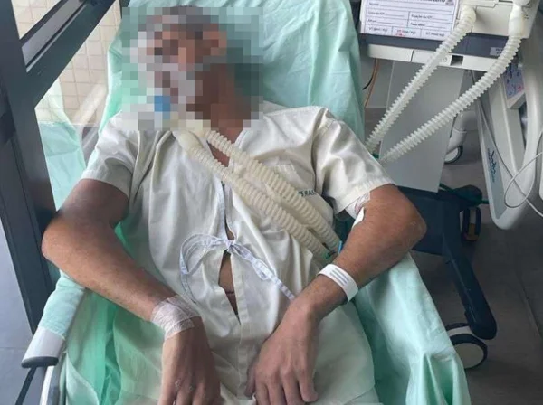 Foto colorida de major da PM de Goiás hospitalizado em estado grave após tortura - Metrópoles