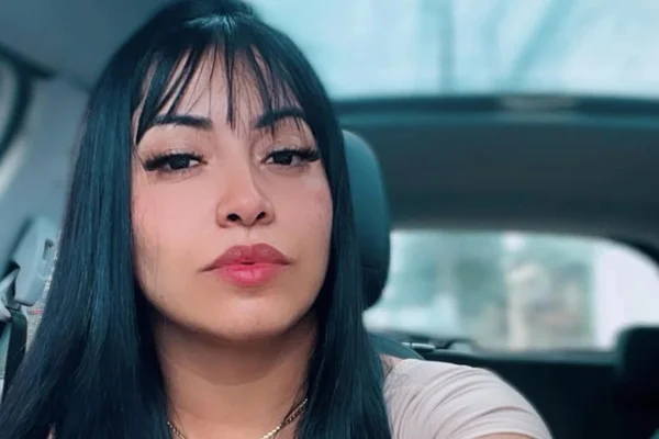 mulher morre preenchimento estético hidrogel
