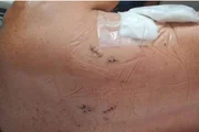 Costas da vítima