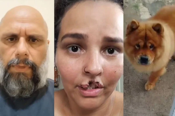 O que homem alegou para sacrificar chow-chow que desfigurou esposa - Metrópoles